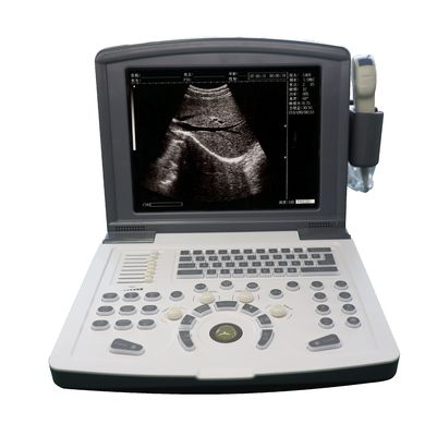 Φορητός πλήρης ψηφιακός διάγνωση υπερήχων scanner OEM