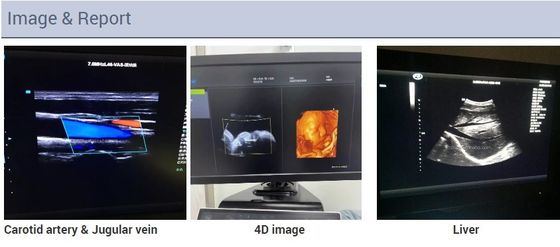 2$α τρισδιάστατη Echocardiography 4D καρδιακή μηχανή υπερήχου Doppler χρώματος ηχούς καροτσακιών