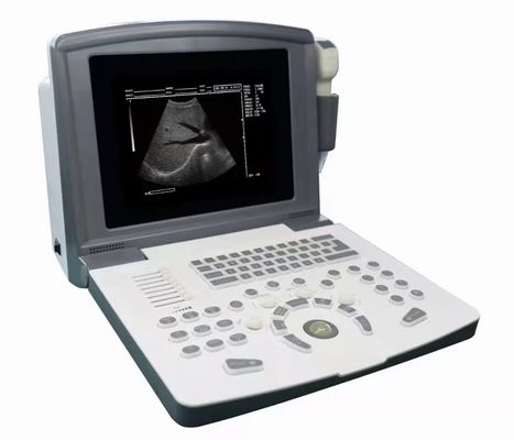 Φορητός πλήρης ψηφιακός διάγνωση υπερήχων scanner OEM