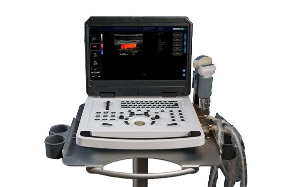 CE φορητός σκάνερ χρώματος Doppler υπερήχων μηχανής OEM