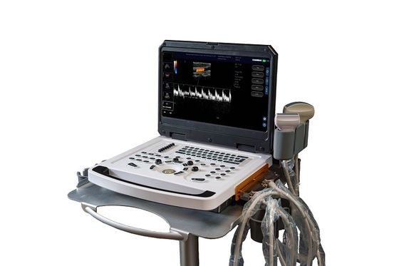 CE φορητός σκάνερ χρώματος Doppler υπερήχων μηχανής OEM